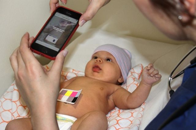 Aplikacja wykrywajca taczk u noworodkw