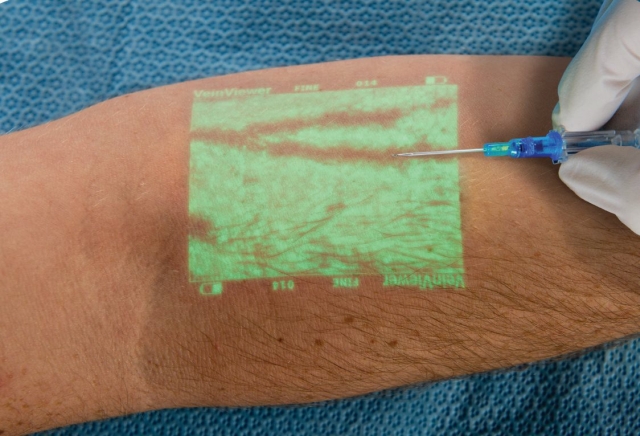 Urzdzenie wykrywajce yy pacjenta VeinViewer